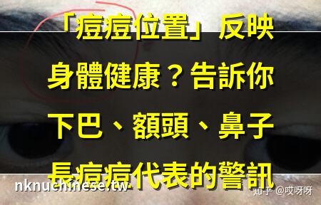 額頭眉毛中間長痘痘怎麼辦｜眉間長痘是怎麼回事