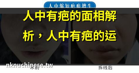人中有疤痕對運勢有什麼影響（人中有疤痕對運勢有什麼影響呢）｜人中有疤的面相解析，人中有疤的運勢預測